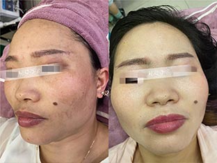 客户使用效果对比