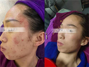 客户使用效果对比