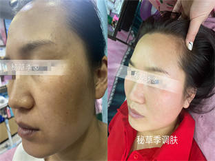 客户使用效果对比